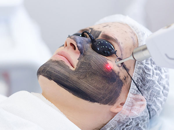 Carbon Facial Treatment